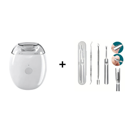 80%OFF💥LETZTER TAG VERKAUF 50% RABATT💥Universeller automatischer Fingernagelschleifer für Erwachsene und Kinder – Einfach & Sicher (Copy) (Copy)