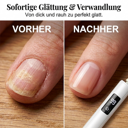 💎 NUR FÜR BEGRENZTE ZEIT: 50 % RABATT! ✨Professionelle elektrische Nagelfeile