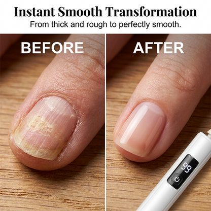 60%off💎 NUR FÜR BEGRENZTE ZEIT: 50 % RABATT! ✨Professionelle elektrische Nagelfeile (Copy)